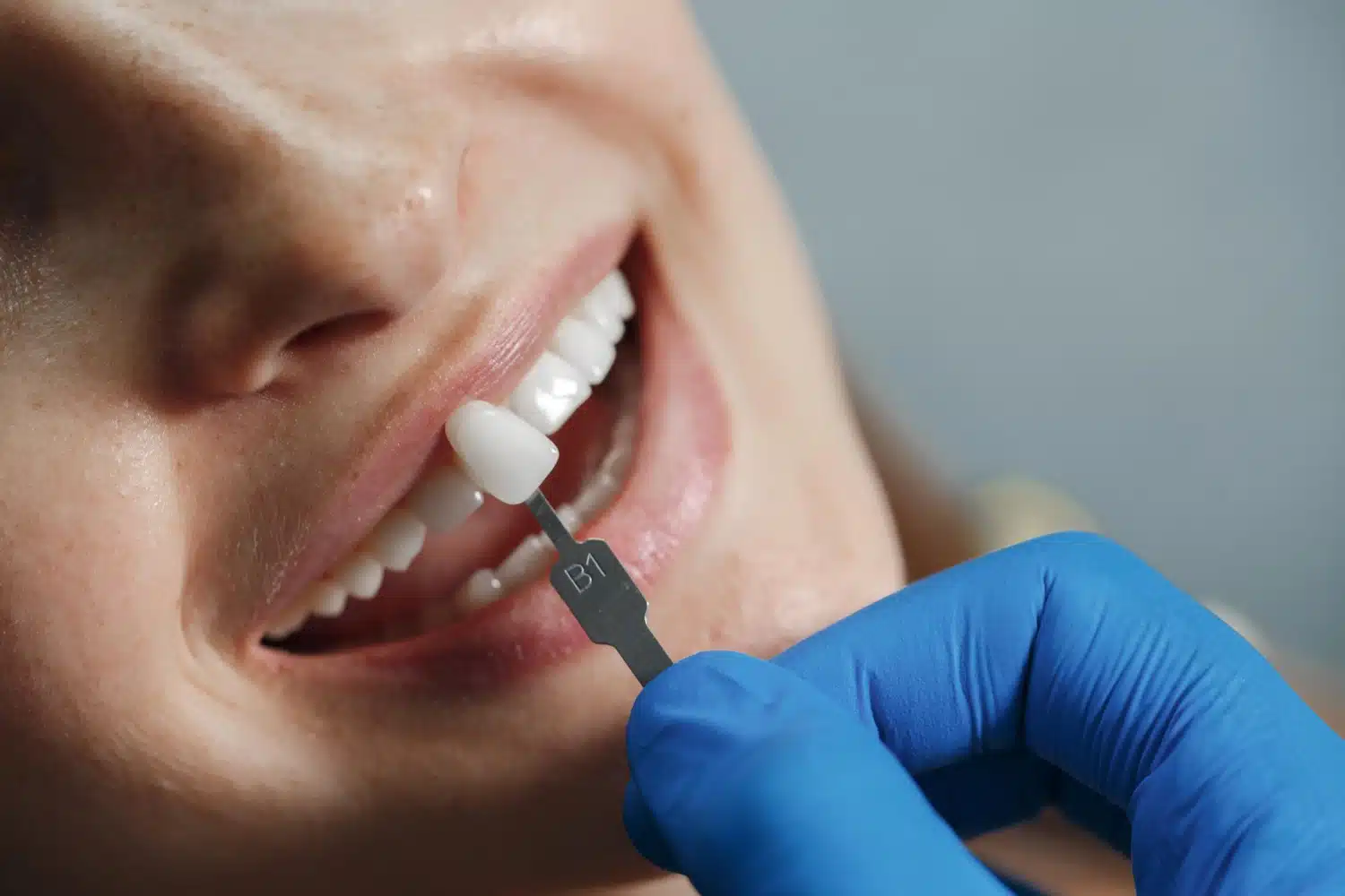 cosmetic dentistry trends