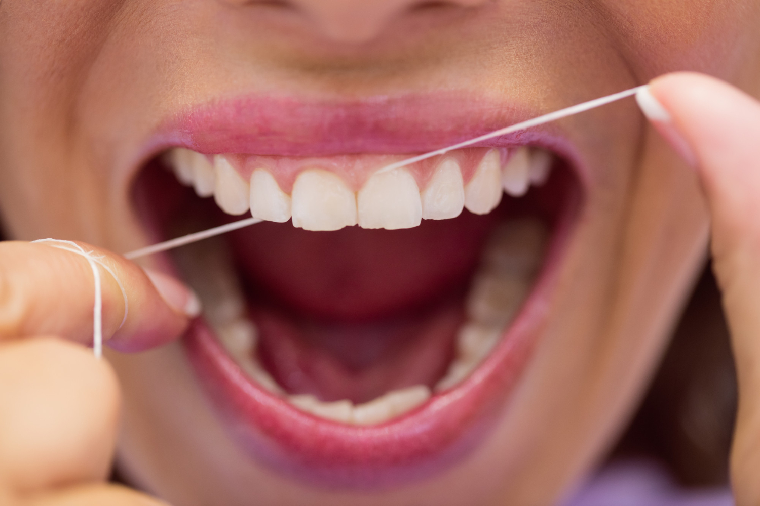 Floss Like a Pro: Mastering the Art of Correct Flossing Technique